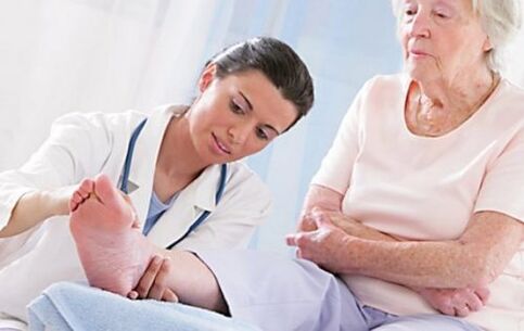 Forduljon orvoshoz, ha visszér tünetei vannak